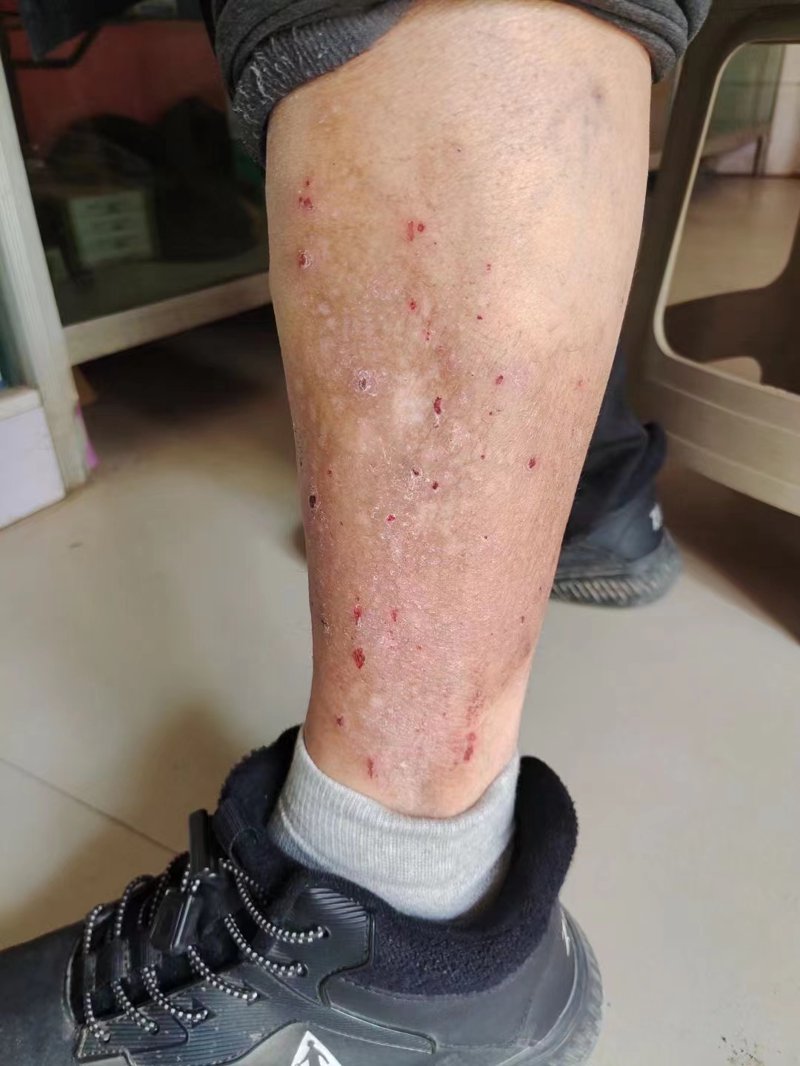 邢台皮肤医院：守护美丽与健康的前沿阵地