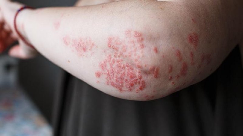 邢台皮肤医院：前沿科技与人文关怀并行的现代医疗典范