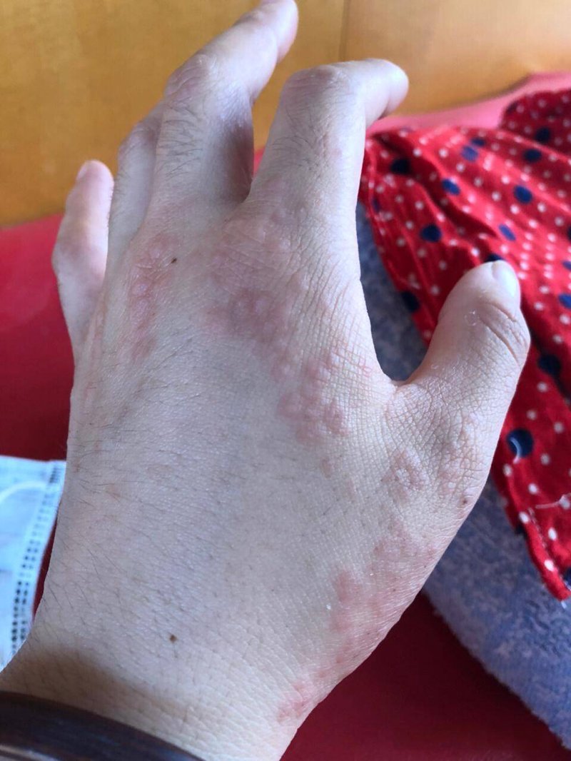 聚焦皮肤健康护理:探索邢台京城皮肤病医院的服务与技术
